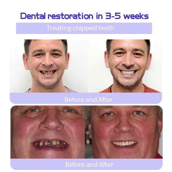 Exclusive Deal Oyikey™Tooth Repair Mineral Powder - Image 15