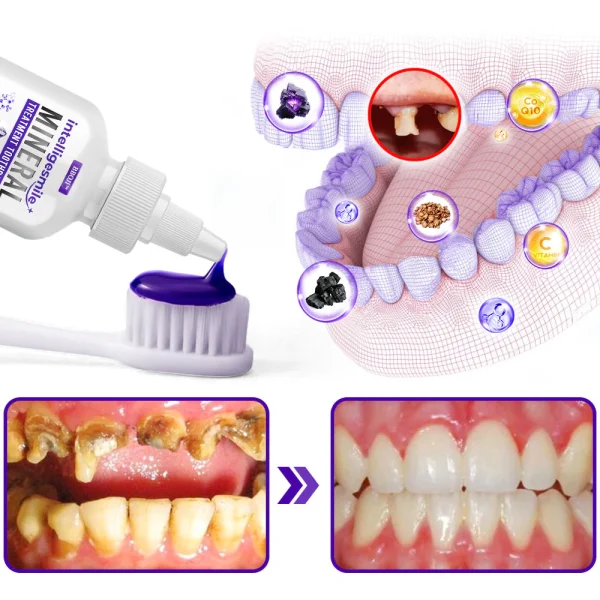 🥇BBOJI™ IntelligeSmile Mineral Treatment Toothpaste - Image 8