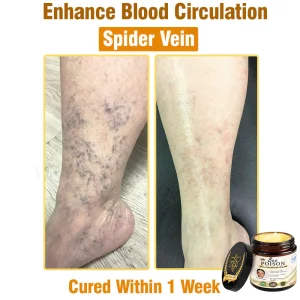 LOVILDS® Full-Body Repair Cream: Anti-Aging, Hydration, Skin Repair, Even Tone, Acne & Dark Spot Treatment, Wart & Mole Removal, Psoriasis Relief