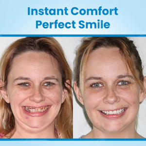 YUNPSO Adaptable Fit Silicone Denture Kit