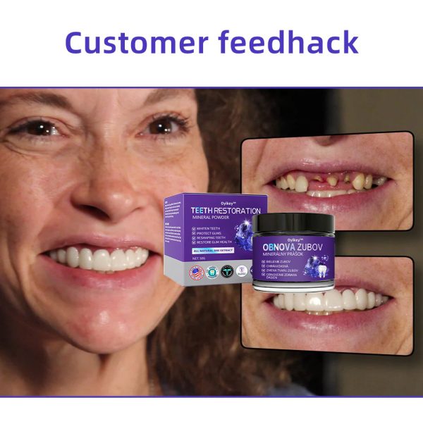 Exclusive Deal Oyikey™Tooth Repair Mineral Powder - Image 8