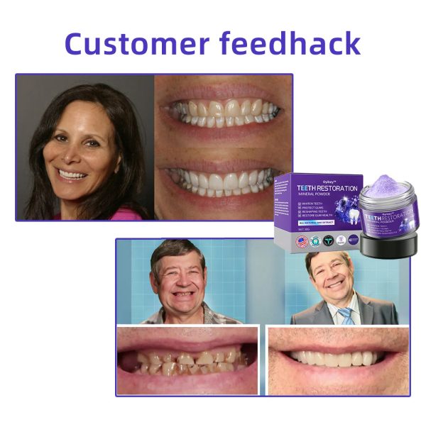 Exclusive Deal Oyikey™Tooth Repair Mineral Powder - Image 9