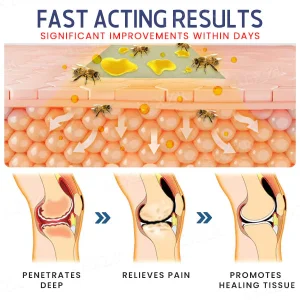 Dobshow™ BeeVenom Joint & Bones Care