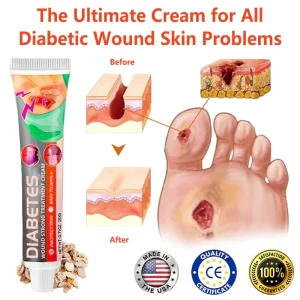 ✨HZA™ Diabetes Wound Strong Treatment Cream