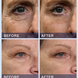 Furzero™ All-in-One Lifting & Firming Serum Smooths wrinkles in 10 minutes, tightens skin, and reduces puffiness and dark circles