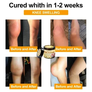 ZVLZVL™ Bee Venom Instant Pain Relief Arthritis Therapy Cream
