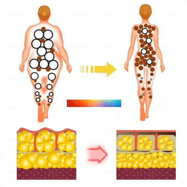 SIE™ Portable Lymphatic Detox And Joint Relaxation Therapy Device‍