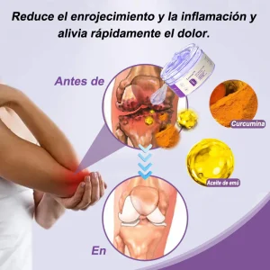 Lenreey™ Arthritic Pain Relief Massage Gel with Turmeric and Rhea Oil