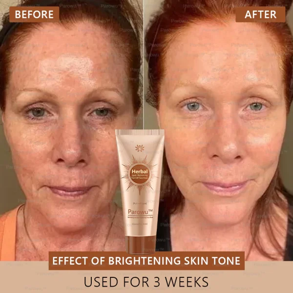 🧡Parowu™ Whitening and Spot-Removing Face Mask Suitable for face and body – 👩‍⚕️ Natural ingredients permanently remove age spots, freckles, sun spots, and liver spots