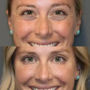 LOVILDS™Instant Wrinkle Eye Tightener cream