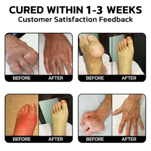 Flysmus™ Turmeric & Emu Oil Arthritis Relieving Pain Relief Massage Gel