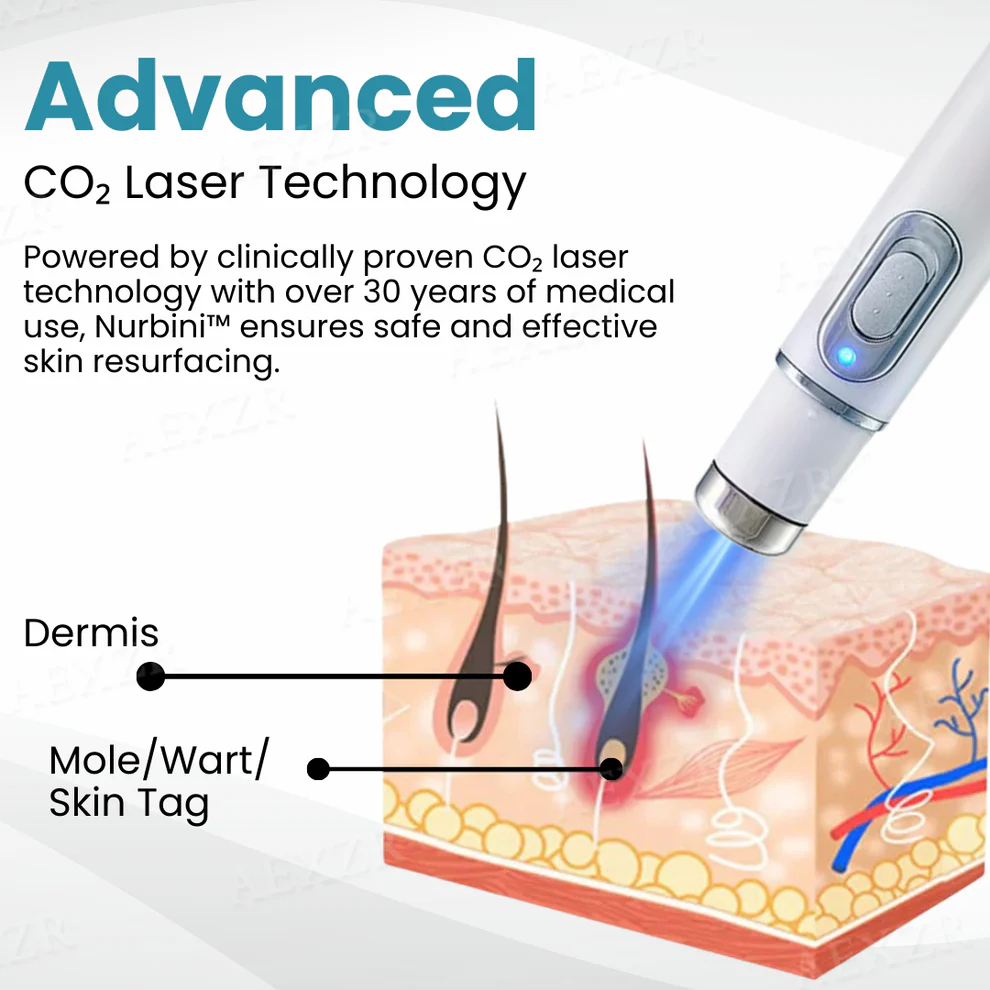 Nurbini™ Non-invasive Mole and Wart Removal Laser Pen 6 Nurbini™ Non-invasive Mole and Wart Removal Laser Pen