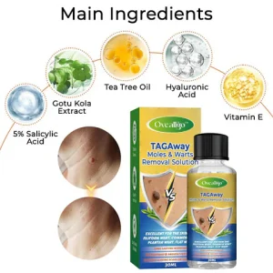 Oveallgo™ TAGAway Moles & Warts Removal Solution 13 Oveallgo™ TAGAway Moles & Warts Removal Solution