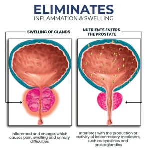 Oveallgo™ NEW BeeProsta Nasal Spray for Prostate Wellness 8 Oveallgo™ NEW BeeProsta Nasal Spray for Prostate Wellness
