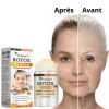 Flysmus™ Bee Venom Ultra-Firming Serum Stick | Erases Wrinkles in 5 Minutes!