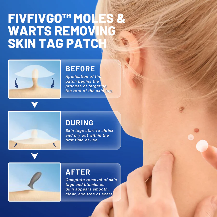 Fivfivgo™ Moles & Warts Removing Skin Tag Patch 3 Fivfivgo™ Moles & Warts Removing Skin Tag Patch