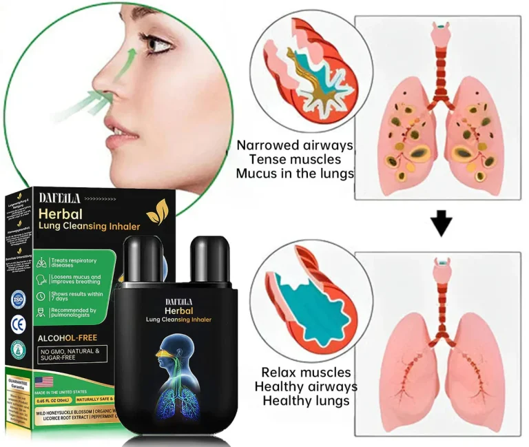 Mega Sale Dafeila™ Herbal Lung Cleansing Inhaler 5 Dafeila™ Herbal Lung Cleansing Inhaler