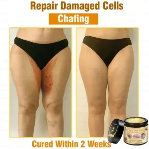 Lotmay™ 7-Day Rapid Skin Rapair Cream US Dermatologist Approved