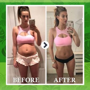 Winter Sale Cvreoz™ Bee Venom Slimming Patch 13 Cvreoz™ Bee Venom Slimming Patch