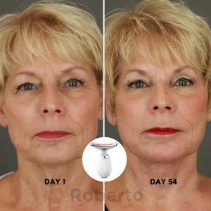 Roberto™ Anti-Aging Device 18 Roberto™ Anti-Aging Device