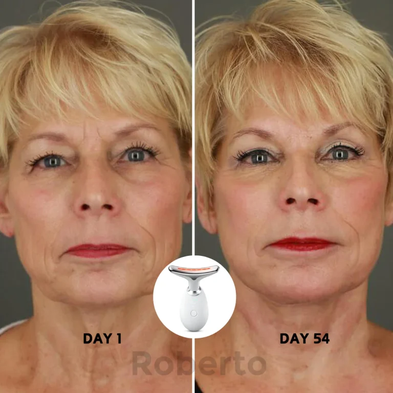Roberto™ Anti-Aging Device 7 Roberto™ Anti-Aging Device