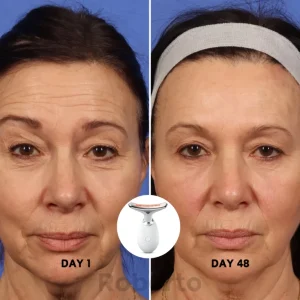 Roberto™ Anti-Aging Device 16 Roberto™ Anti-Aging Device