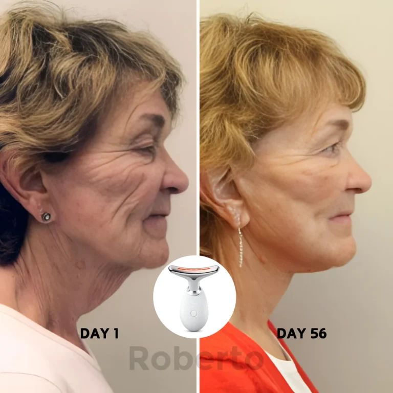 Roberto™ Anti-Aging Device 4 Roberto™ Anti-Aging Device