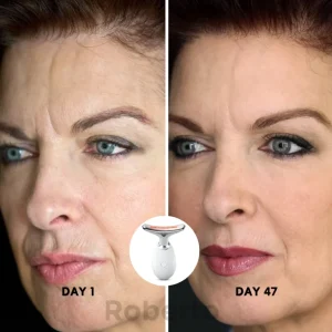 Roberto™ Anti-Aging Device 14 Roberto™ Anti-Aging Device