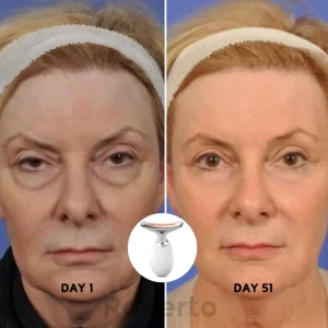 Roberto™ Anti-Aging Device 17 Roberto™ Anti-Aging Device