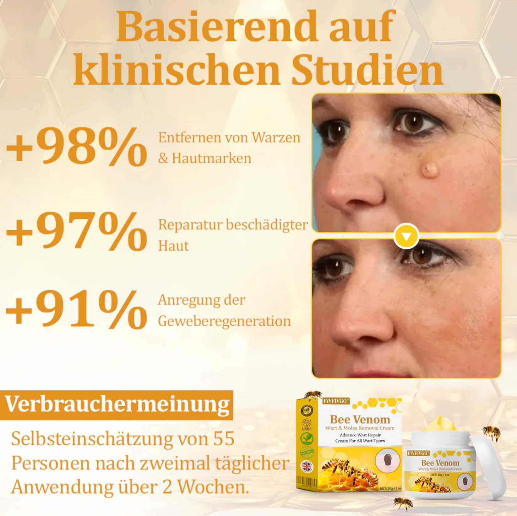 Fivfivgo™ TagCure Bee Venom Cream for Wart and Mole Removal 4 Fivfivgo™ TagCure Bee Venom Cream for Wart and Mole Removal