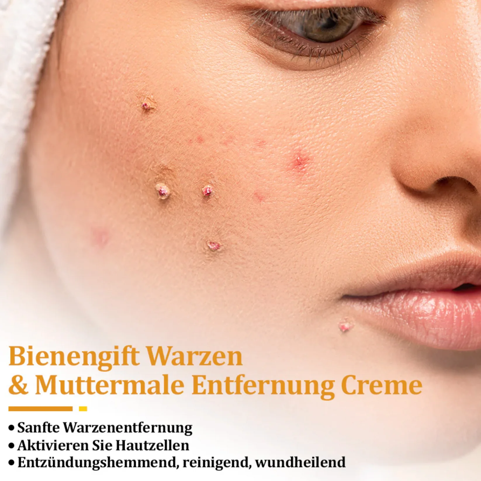 Fivfivgo™ TagCure Bee Venom Cream for Wart and Mole Removal 3 Fivfivgo™ TagCure Bee Venom Cream for Wart and Mole Removal