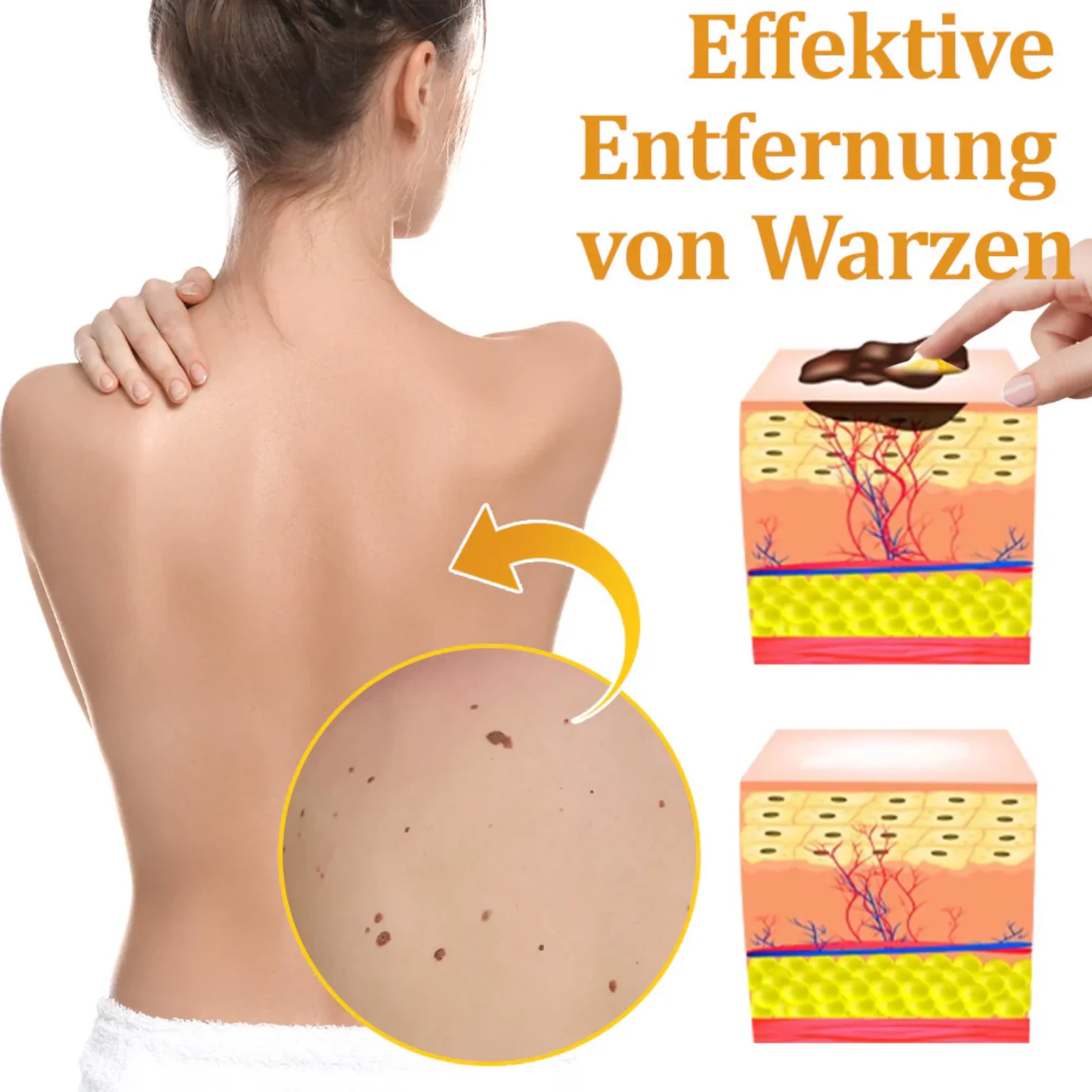 Fivfivgo™ TagCure Bee Venom Cream for Wart and Mole Removal 8 Fivfivgo™ TagCure Bee Venom Cream for Wart and Mole Removal - Image 8