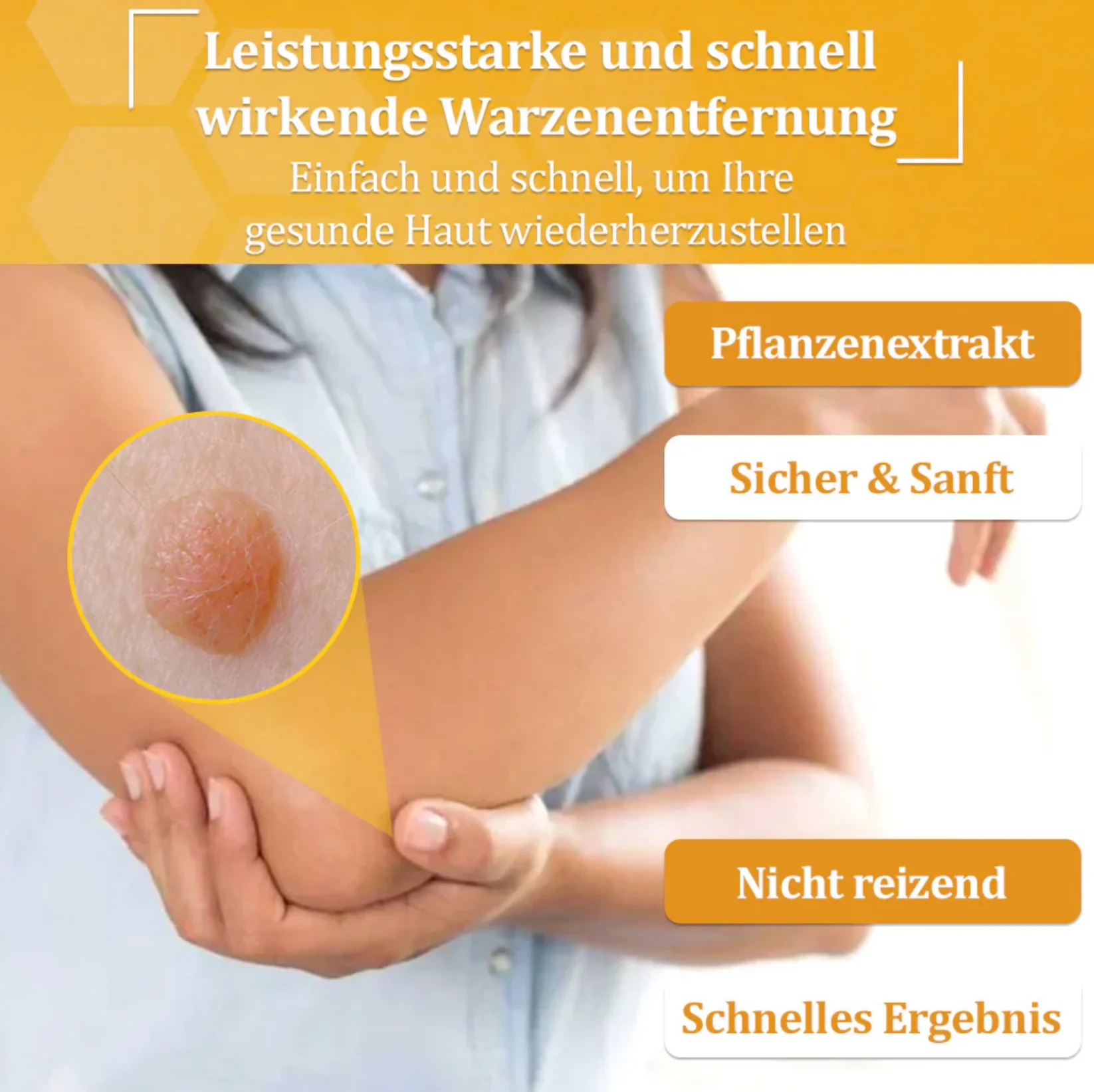 Fivfivgo™ TagCure Bee Venom Cream for Wart and Mole Removal 9 Fivfivgo™ TagCure Bee Venom Cream for Wart and Mole Removal - Image 9