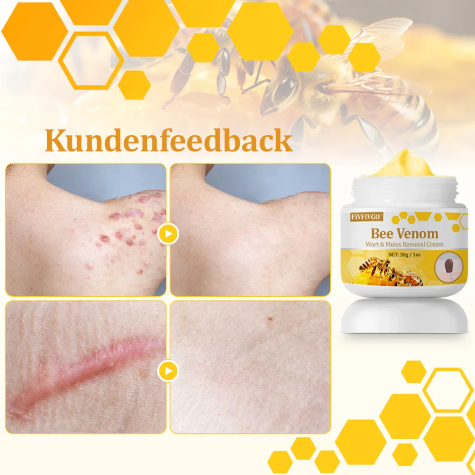 Fivfivgo™ TagCure Bee Venom Cream for Wart and Mole Removal 12 Fivfivgo™ TagCure Bee Venom Cream for Wart and Mole Removal - Image 12