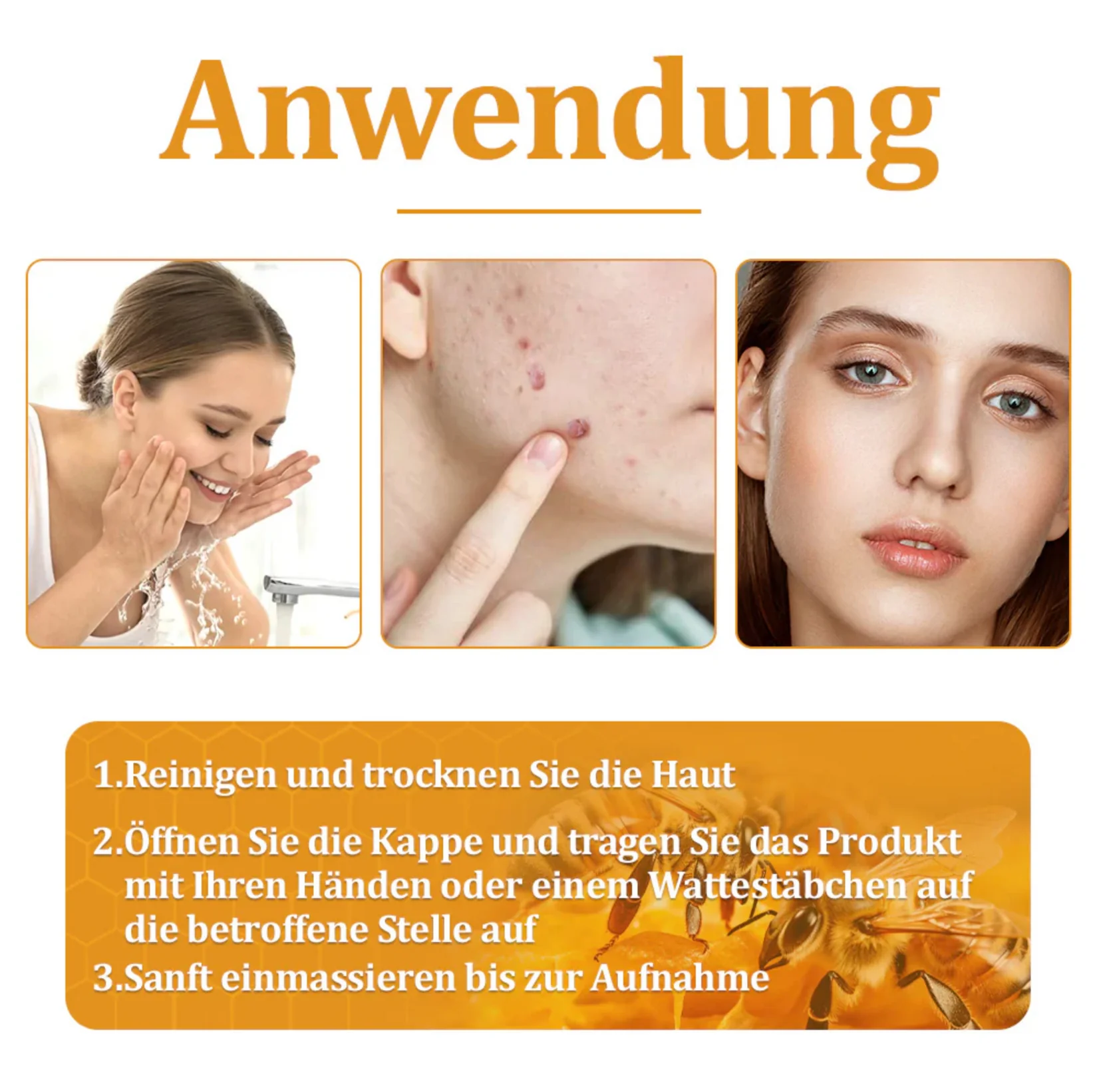 Fivfivgo™ TagCure Bee Venom Cream for Wart and Mole Removal 14 Fivfivgo™ TagCure Bee Venom Cream for Wart and Mole Removal - Image 14