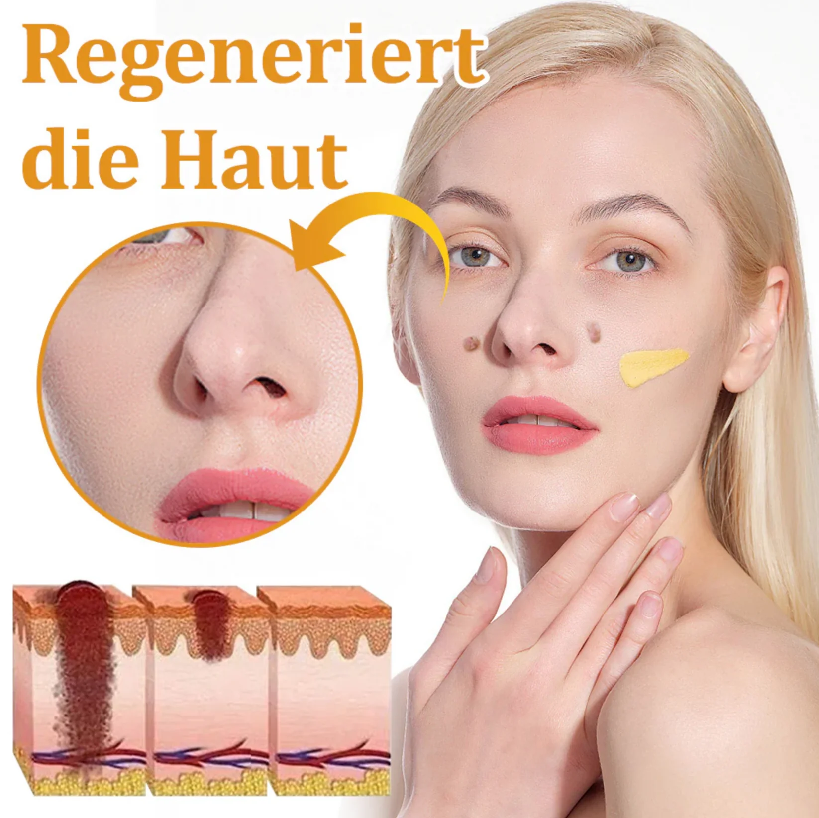 Fivfivgo™ TagCure Bee Venom Cream for Wart and Mole Removal 15 Fivfivgo™ TagCure Bee Venom Cream for Wart and Mole Removal - Image 15