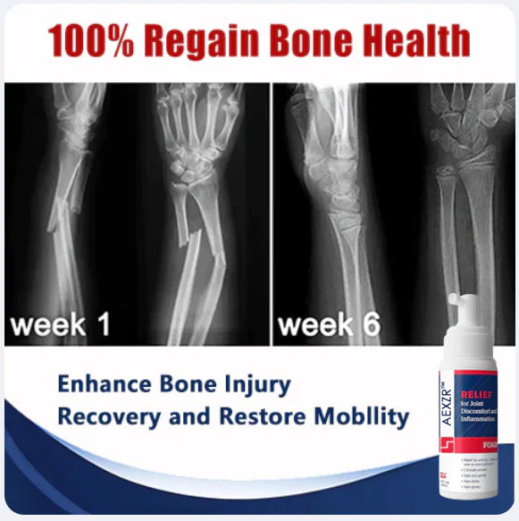 Seurico™ Joint & Bone Pain Foam Spray 4 Seurico™ Joint & Bone Pain Foam Spray