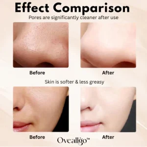 Oveallgo™ Ultrasonic Skin Spatula