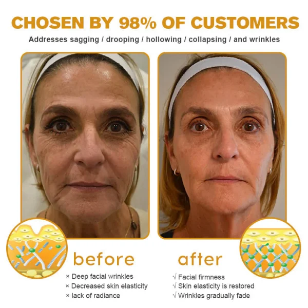 APKAPK™ Bee Venom Skin Treatment Cream, Anti-aging, Hydrating, Skin Repair, Even Tone, Acne and Dark Spot Treatment, Wart and Mole Removal, Psoriasis Relief - Image 13