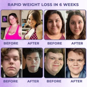 Dobshow® Meglutide Slimming Aromatherapy Oil 13 Dobshow® Meglutide Slimming Aromatherapy Oil