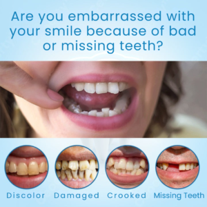 EverSmile™ | Get a perfect and spectacular smile 7 EverSmile™ | Get a perfect and spectacular smile