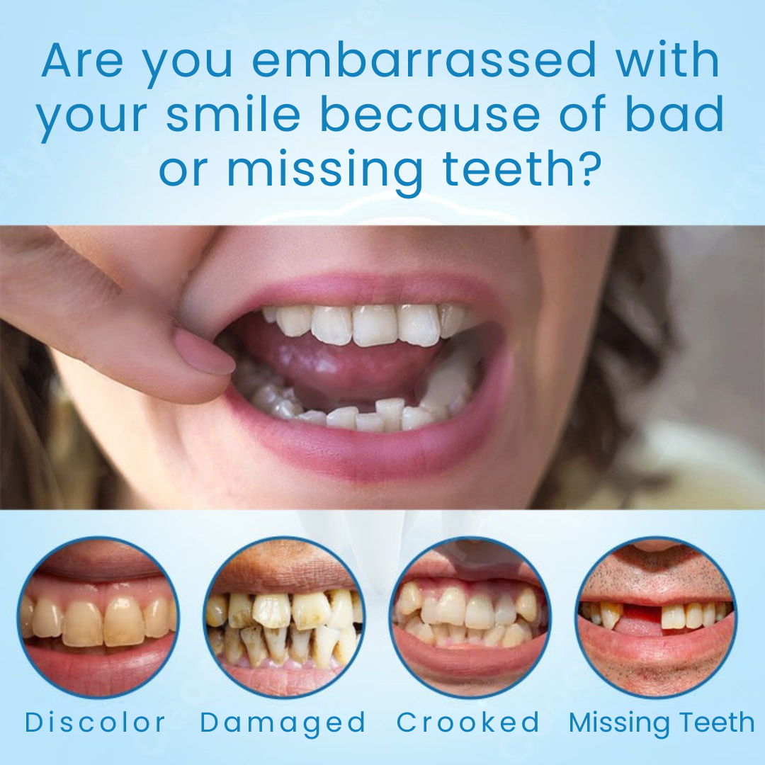 EverSmile™ | Get a perfect and spectacular smile 3 EverSmile™ | Get a perfect and spectacular smile