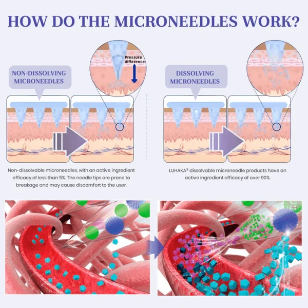 Luhaka® NIDDK-Tirzepatide Nano Microneedle Patch