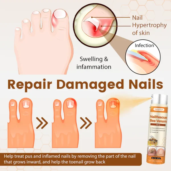Ceoerty® NailRescue Bee Venom Spray