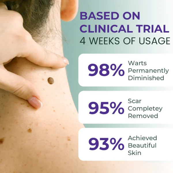 Fivfivgo® Clarivine Dissolver Mole & Dark Spot Removal Bio-Gel - Image 4