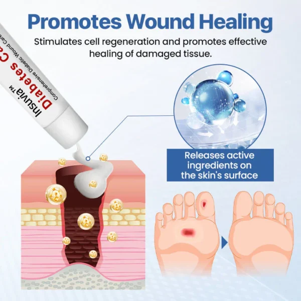 Insuvia™ VitaGluco Diabetes Treatment Cream