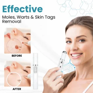 LAOZIK® Non-Invasive Mole and Wart Removal Laser Pen 11 LAOZIK® Non-Invasive Mole and Wart Removal Laser Pen
