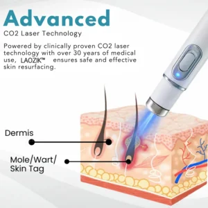 LAOZIK® Non-Invasive Mole and Wart Removal Laser Pen 12 LAOZIK® Non-Invasive Mole and Wart Removal Laser Pen