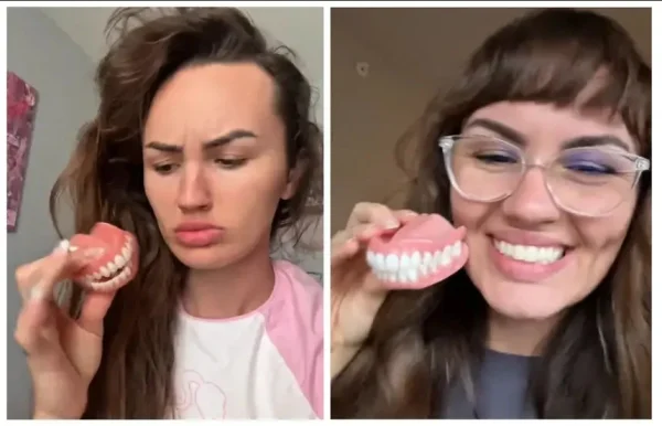 BQYOOM™ custom dentures - Image 6