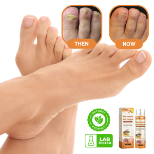 NailCare™ Nail Fungus Spray